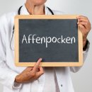 Arzt hält ein Schild hoch. Dort ist mit Kreide das Wort Affenpocken draufgeschrieben.