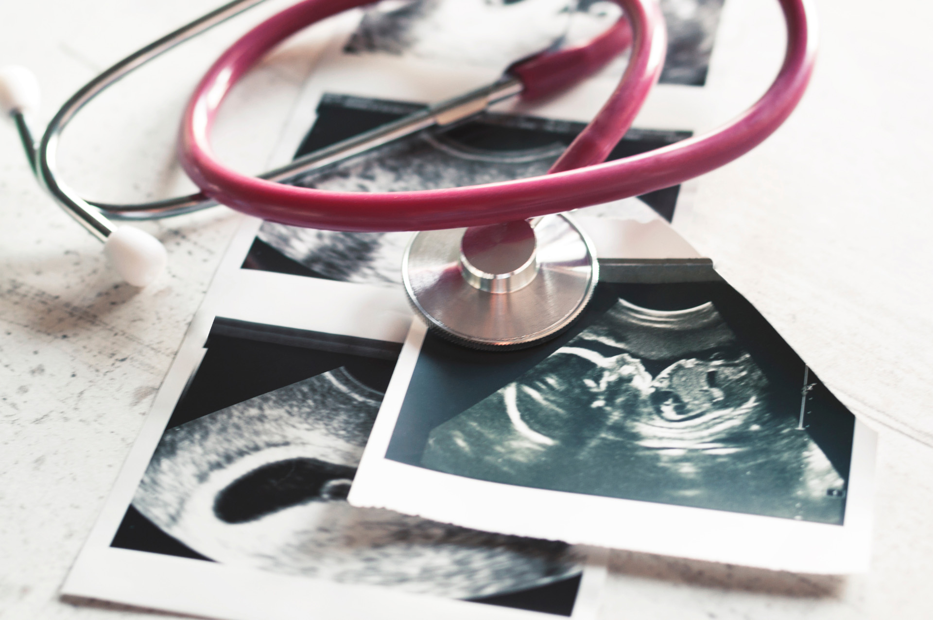 Mehrere Ultraschallbilder eines ungeborenen Babys liegen auf einem Tisch, darüber ein pinkfarbenes Stethoskop.