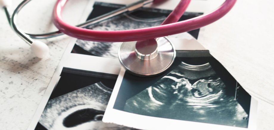 Mehrere Ultraschallbilder eines ungeborenen Babys liegen auf einem Tisch, darüber ein pinkfarbenes Stethoskop.
